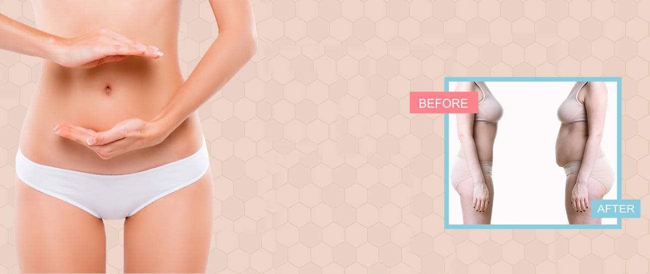 tummy tuck cost in bhopal