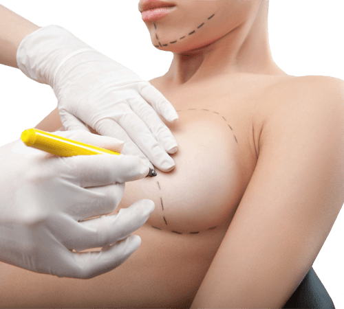 breast surgery in indore