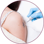 Tattoo Removal cost in indore