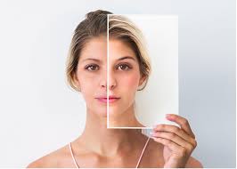 Cosmetic Surgery