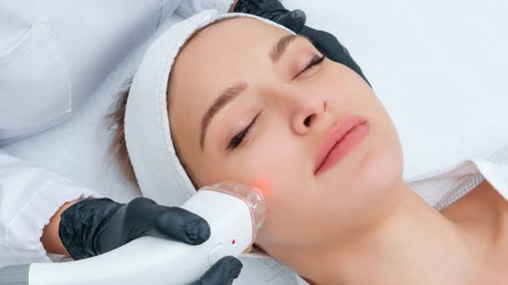 Radio Frequency Facial