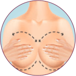 Breast Treatment in Indore