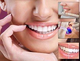 Dental Implant in Indore